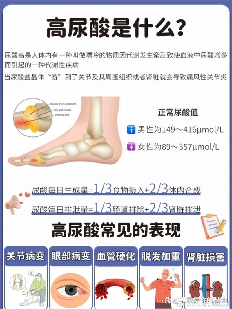 验血查痛风挂什么科