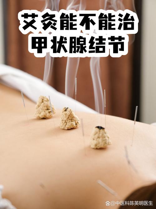 甲状腺结节针灸穴位